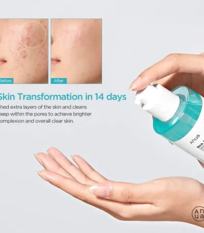 Anua BHA 2% Gentle Exfoliating Toner 150ml