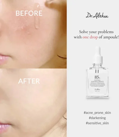 DR. ALTHEA NATURAL RADIANCE ESSENCE 30ML